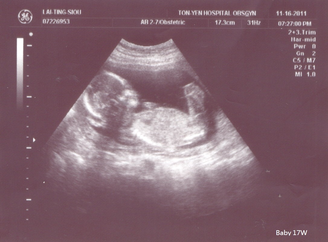 Baby-17W